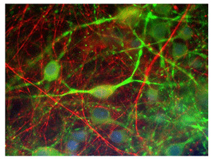 Anti-Alpha Internexin/ NF-66, clone ID2