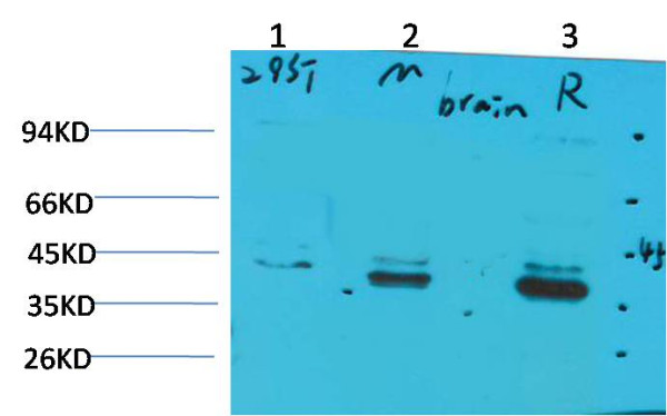 Anti-CABP2