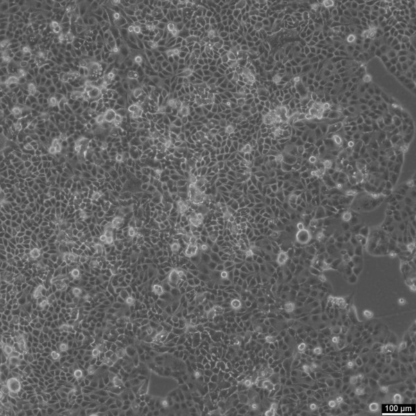 HEC-1-A Cells