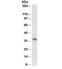 Anti-CD74