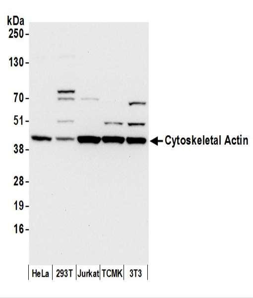 Anti-Cytoskeletal Actin