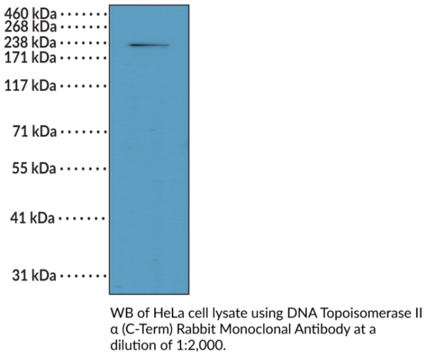 Anti-DNA Topoisomerase IIalpha (C-Term) Rabbit Monoclonal Antibody (RM394)