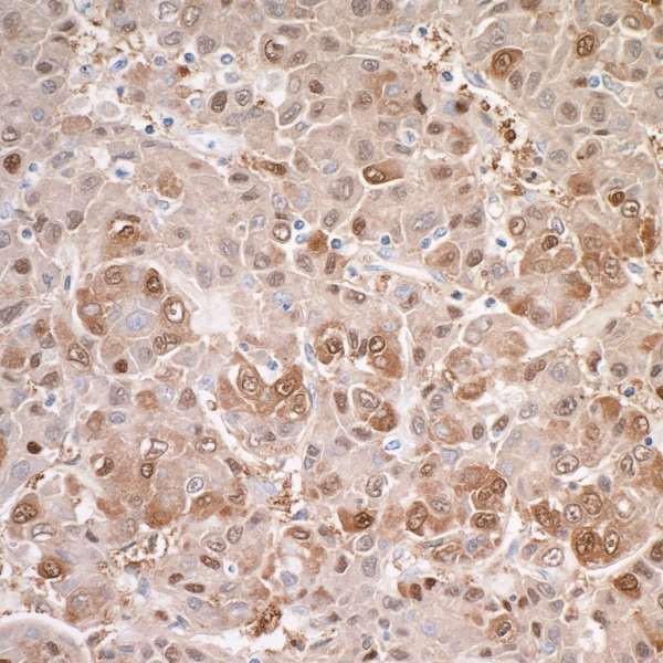 Anti-Arginase 1 Recombinant Monoclonal