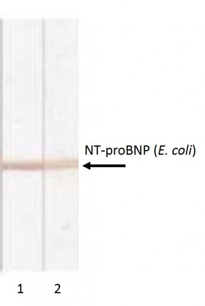 Anti-proBNP, clone 11D1