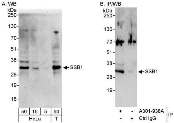 Anti-SSB1