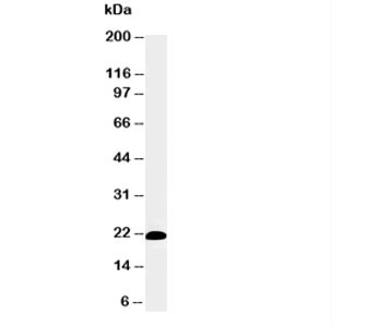 Anti-Myosin Skeletal Slow, clone NOQ7.5.4D
