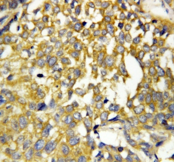 Anti-Pleiotrophin