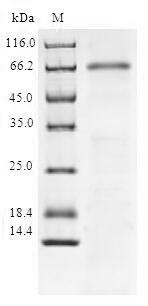 NAD-dependent protein deacetylase sirtuin-6 (SIRT6), human, recombinant