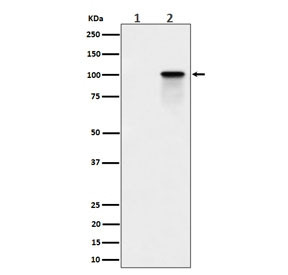 Anti-phospho-Nucleolin (Thr84), clone 29N17