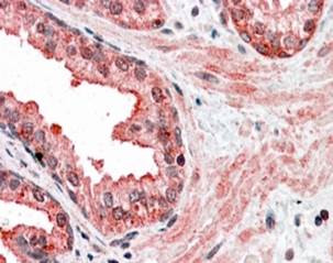 Anti-CCNDBP1, C-terminal