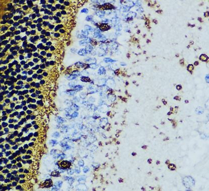 Anti-Recoverin