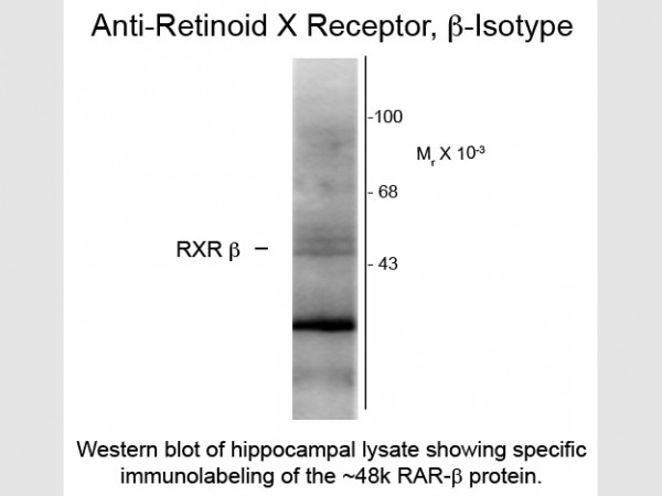 Anti-Retinoid X Receptor Beta, clone 147