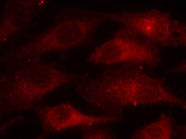 Anti-phospho-Caveolin-1 (Tyr14)