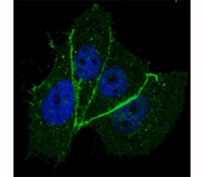 Anti-HER2 (ERBB2) (phospho-T1172)