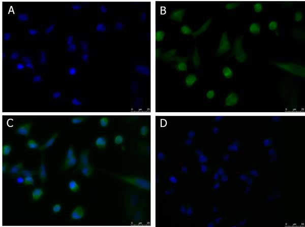 Anti-PDL1