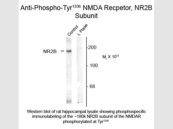Anti-phospho-NMDA NR2B Subunit (Tyr1336)