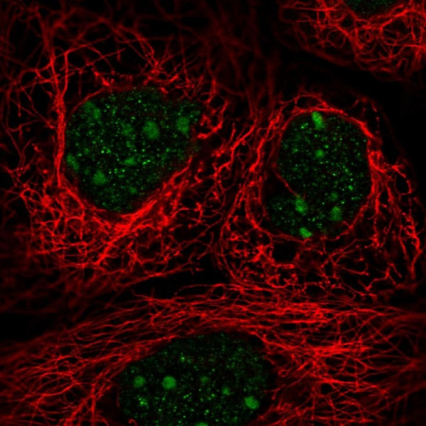 Anti-TRA2A