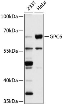 Anti-GPC6