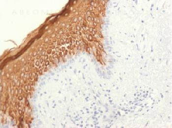 Anti-Cytokeratin 10 (Suprabasal Epithelial Marker) Recombinant Rabbit Monoclonal Antibody (clone:KRT