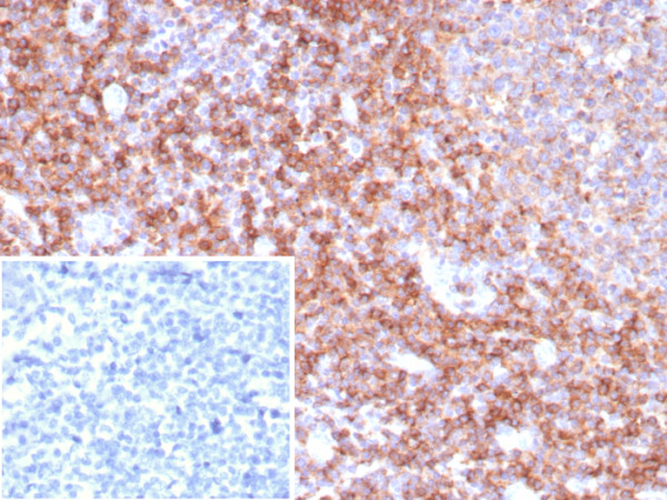 Anti-CD39 / ENTPD1 (Marker of Tumor-specific T cells), recombinant antibody, clone CD39/8538R