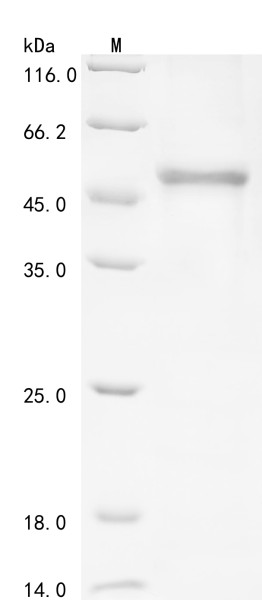 Deleted in azoospermia-like (DAZL), partial, human, recombinant