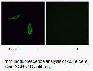 Anti-SCNN1D