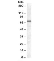 Anti-COL4A3BP