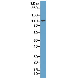 Anti-E-Cadherin, clone RM244 (recombinant antibody)
