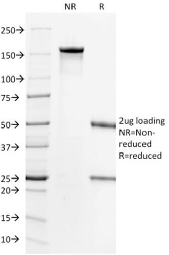 Anti-HER-2 / CD340(HRB2/718), Biotin conjugate, 0.1mg/mL