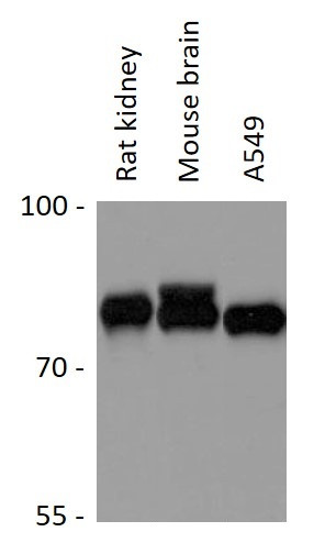Anti-Guanylate Cyclase alpha