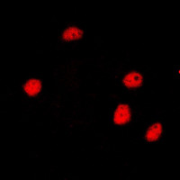 Anti-NCOR2 / SMRT