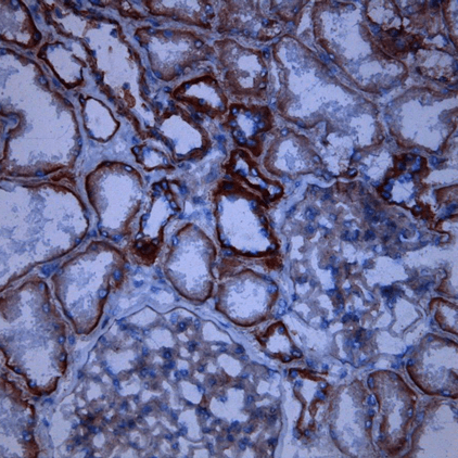 Anti-CD46, Human, mAb M177