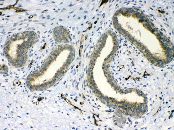 Anti-PPID / cyclophilin 40