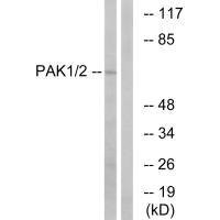 Anti-PAK1 (Ab-199)