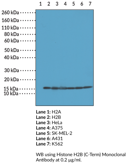 Anti-Histone H2B (C-Term) Monoclonal Antibody (Clone RM230)