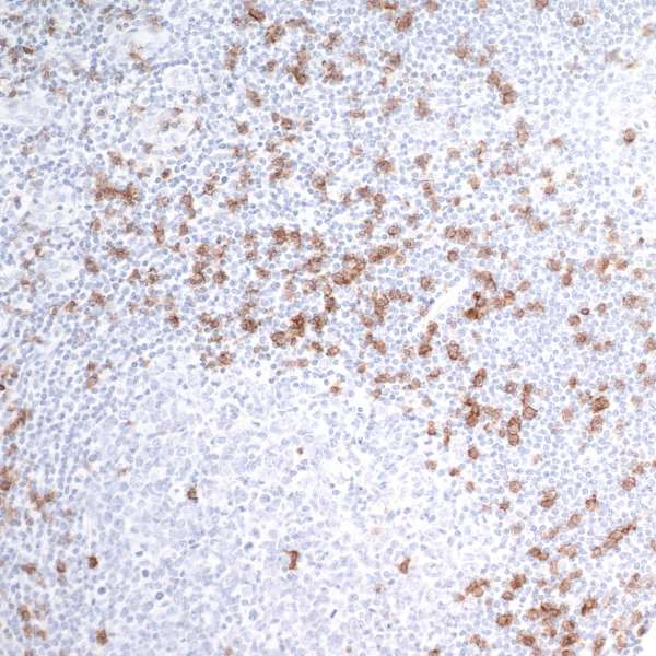 Anti-CD8 alpha Recombinant Monoclonal