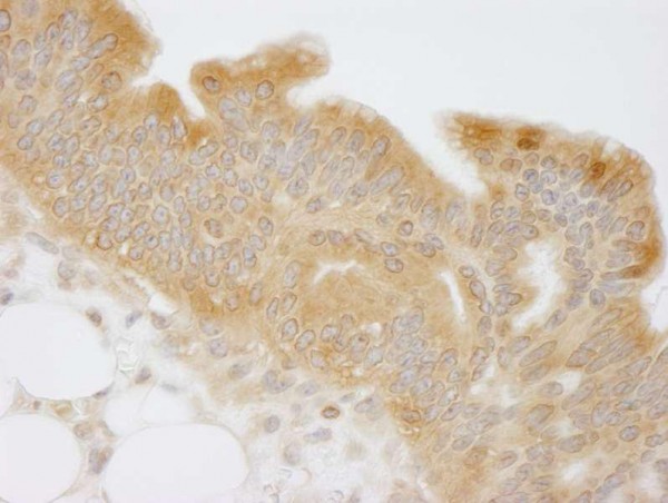 Anti-NMI (IHC)