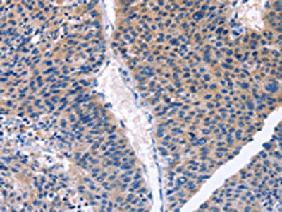 Anti-CDK2