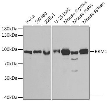 Anti-RRM1