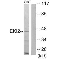 Anti-ETNK2