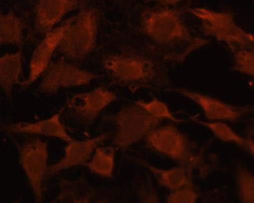 Anti-Hsp 40