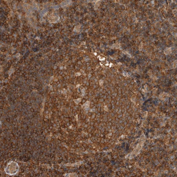 Anti-PFDN4