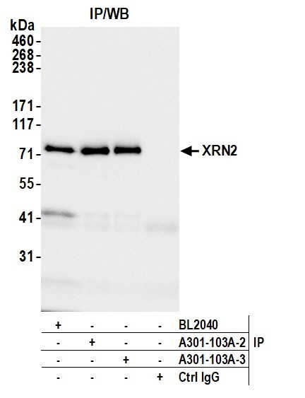 Anti-XRN2