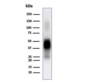 Anti-GFAP / Glial Fibrillary Acidic Protein, clone GFAP/6884
