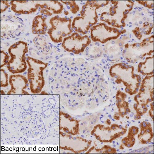Anti-CA5B