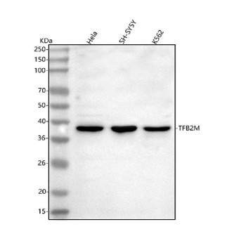 Anti-TFB2M / Transcription factor B2, mitochondrial