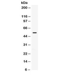 Anti-TGFBR1 / TGF beta Receptor I