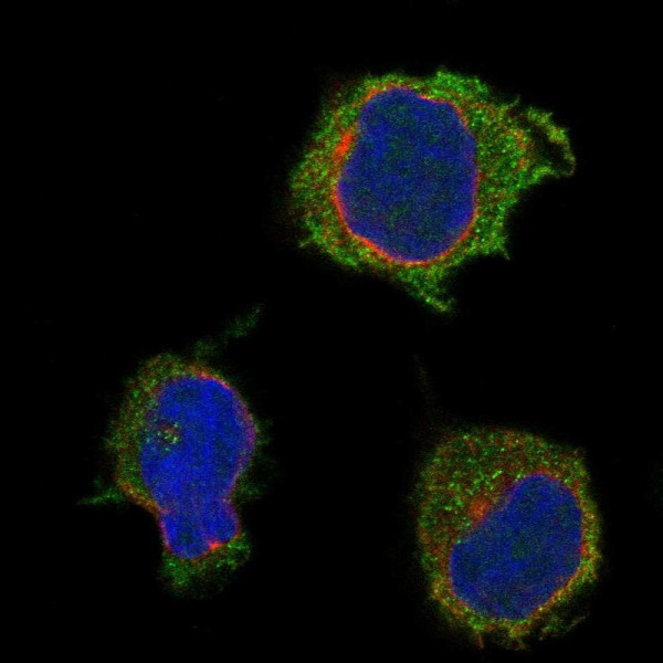 Anti-PSTPIP1