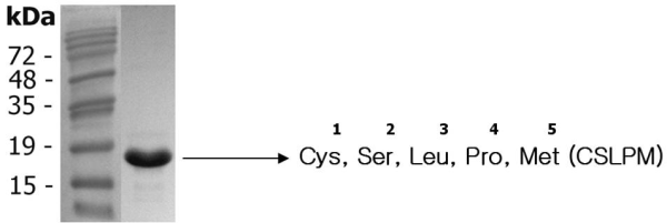 IL-38 (human) (rec.) (His)