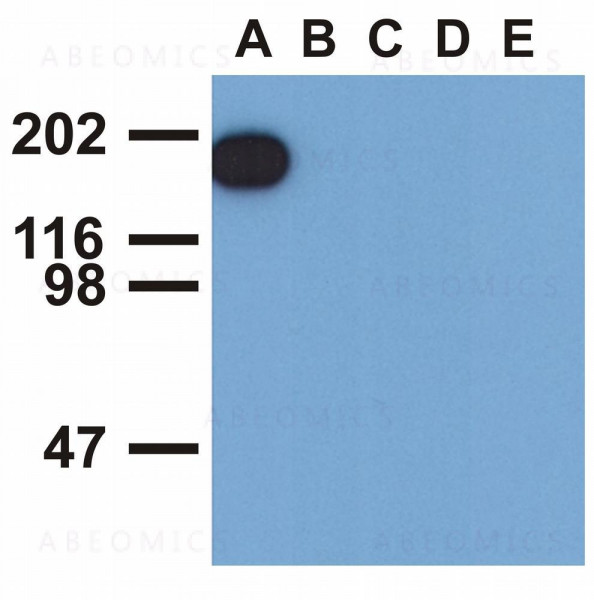Anti-phospho-EGFR (Tyr1173) Monoclonal Antibody (Clone:EM-13)
